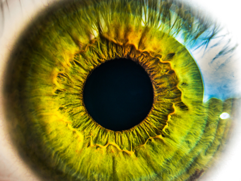 Oeil_maladies_oculaires_Nikon_Optos_Verily_Google